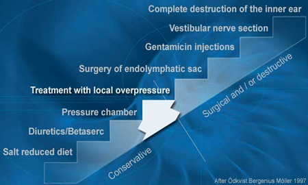 Ménière’s Disease Treatment Overview Ménière’s Disease Treatment Overview