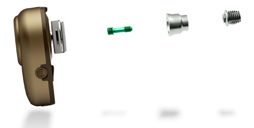 Parts of a BAHA