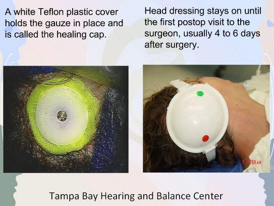 Gauze and Healing Cap